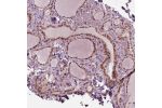 Immunohistochemical staining of human thyroid gland shows strong nuclear positivity in glandular cells.