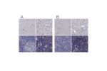 Immunohistochemical staining of human cerebral cortex, liver, lymph node and thymus using Anti-UHRF1 antibody HPA055446 (A) shows similar protein distribution across tissues to independent antibody HPA049408 (B).