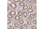 Immunohistochemical staining of human stomach, lower shows moderate cytoplasmic and nuclear positivity in glandular cells.