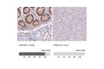 Immunohistochemistry analysis in human colon and liver tissues using HPA055478 antibody. Corresponding HHLA2 RNA-seq data are presented for the same tissues.