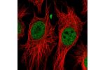 Immunofluorescent staining of human cell line HeLa shows localization to nucleoplasm.