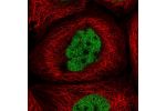 Immunofluorescent staining of human cell line A-431 shows localization to nucleoplasm.