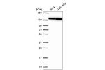Western blot analysis in human cell line RT-4 and human cell line U-251 MG.