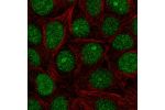 Immunofluorescent staining of human cell line MCF7 shows localization to nucleus & nucleoli.