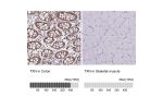Immunohistochemistry analysis in human colon and skeletal muscle tissues using HPA055752 antibody. Corresponding TXN RNA-seq data are presented for the same tissues.