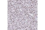 Immunohistochemical staining of human liver shows strong nuclear positivity in hepatocytes.
