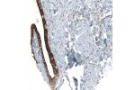 Immunohistochemical staining of human fallopian tube shows strong membranous positivity in glandular cells.