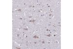 Immunohistochemical staining of human cerebral cortex shows moderate cytoplasmic positivity in neuronal cells.