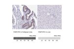 Immunohistochemistry analysis in human fallopian tube and liver tissues using HPA055888 antibody. Corresponding FAM107A RNA-seq data are presented for the same tissues.