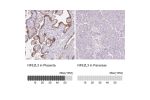 Immunohistochemistry analysis in human placenta and pancreas tissues using HPA055889 antibody. Corresponding NFE2L3 RNA-seq data are presented for the same tissues.