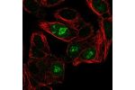 Immunofluorescent staining of human cell line Hep G2 shows localization to nucleoli rim & mitotic chromosome.