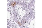 Immunohistochemical staining of human testis shows strong nuclear and cytoplasmic positivity in Leydig cells.