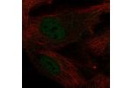 Immunofluorescent staining of human cell line BJ shows localization to nucleoplasm.