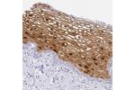 Immunohistochemical staining of human vagina shows strong cytoplasmic and nuclear positivity in squamous epithelial cells.