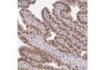Immunohistochemical staining of human Fallopian tube shows moderate nuclear positivity in glandular cells.