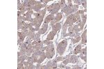 Immunohistochemical staining of human parathyroid gland shows moderate cytoplasmic positivity in glandular cells.