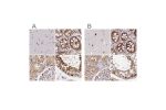 Immunohistochemical staining of human cerebral cortex, colon, kidney and testis using Anti-PSMD7 antibody HPA056069 (A) shows similar protein distribution across tissues to independent antibody HPA049824 (B).