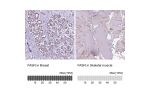 Immunohistochemistry analysis in human breast and skeletal muscle tissues using Anti-FASN antibody. Corresponding FASN RNA-seq data are presented for the same tissues.