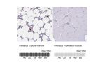 Immunohistochemistry analysis in human bone marrow and skeletal muscle tissues using HPA056183 antibody. Corresponding RNASE3 RNA-seq data are presented for the same tissues.