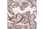Immunohistochemical staining of human placenta shows strong nuclear positivity in trophoblastic cells.