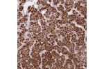 Immunohistochemical staining of human adrenal gland shows strong granular cytoplasmic positivity in glandular cells.