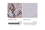 Immunohistochemistry analysis in human kidney and liver tissues using Anti-HSD11B2 antibody. Corresponding HSD11B2 RNA-seq data are presented for the same tissues.