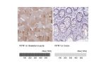 Immunohistochemistry analysis in human skeletal muscle and colon tissues using Anti-RYR1 antibody. Corresponding RYR1 RNA-seq data are presented for the same tissues.