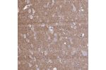 Immunohistochemical staining of human cerebral cortex shows cytopalsmic positivity in processes.
