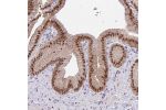 Immunohistochemical staining of human thyroid gland shows moderate nuclear positivity in glandular cells.