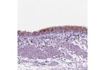 Immunohistochemical staining of human bronchus shows strong positivity in respiratory epithelial cells.