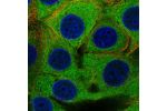 Immunofluorescent staining of human cell line MCF7 shows localization to cytosol.