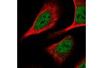 Immunofluorescent staining of human cell line U-2 OS shows localization to nucleoplasm.