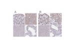 Immunohistochemical staining of human colon, kidney, liver and testis using Anti-RBL1 antibody HPA056525 (A) shows similar protein distribution across tissues to independent antibody HPA054962 (B).