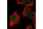 Immunofluorescent staining of human cell line A549 shows localization to nucleoplasm.