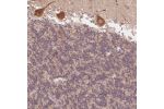 Immunohistochemical staining of human cerebellum shows strong granular cytoplasmic positivity in Purkinje cells.