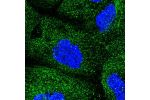 Immunofluorescent staining of human cell line A-431 shows localization to cytosol.