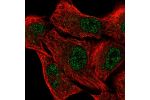 Immunofluorescent staining of human cell line A549 shows localization to nucleoplasm.