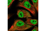 Immunofluorescent staining of human cell line A549 shows localization to nucleoplasm & cytosol.