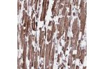 Immunohistochemical staining of human heart muscle shows strong cytoplasmic positivity in myocytes.