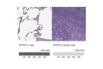 Immunohistochemistry analysis in human lung and lymph node tissues using HPA056768 antibody. Corresponding SFTPD RNA-seq data are presented for the same tissues.