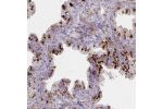 Immunohistochemical staining of human cerebral cortex shows moderate cytoplasmic positivity in neuronal cells. Distinct staining was observed in fraction of neuropil.