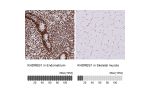 Immunohistochemistry analysis in human endometrium and skeletal muscle tissues using Anti-KHDRBS1 antibody. Corresponding KHDRBS1 RNA-seq data are presented for the same tissues.