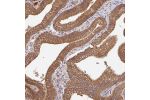 Immunohistochemical staining of human gallbladder shows strong cytoplasmic positivity in glandular cells.