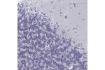 Immunohistochemical staining of human cerebellum shows moderate nucleolar positivity in Purkinje cells.