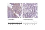 Immunohistochemistry analysis in human esophagus and stomach tissues using Anti-DSG3 antibody. Corresponding DSG3 RNA-seq data are presented for the same tissues.