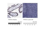 Immunohistochemistry analysis in human placenta and colon tissues using Anti-TFAP2A antibody. Corresponding TFAP2A RNA-seq data are presented for the same tissues.