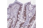 Immunohistochemical staining of human colon shows moderate nuclear positivity in glandular cells.
