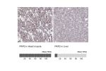 Immunohistochemistry analysis in human heart muscle and liver tissues using HPA056908 antibody. Corresponding PKP2 RNA-seq data are presented for the same tissues.