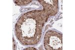 Immunohistochemical staining of human testis shows strong cytoplasmic positivity in cells in seminiferous ducts.