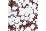 Immunohistochemical staining of human bone marrow shows strong cytoplasmic and mebranous positivity in hematopoietic cells.